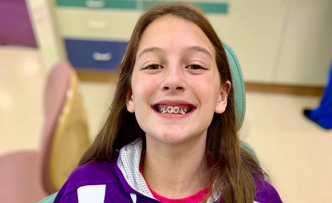 New Year, New Smile Why 2024 is the Perfect Time to Start Children’s Braces